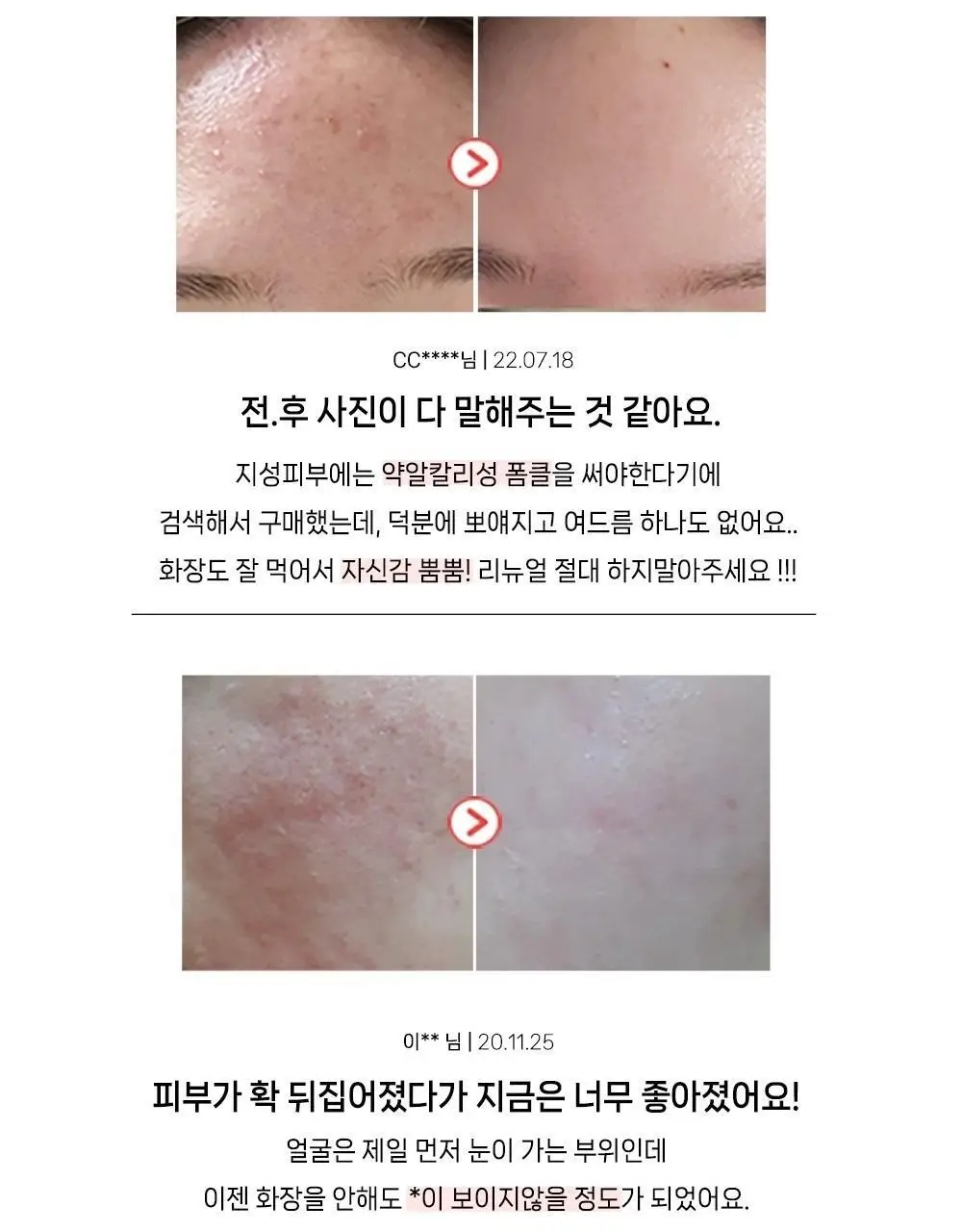 [여드름기능성/약알칼리성] 아토뮤 아크리스 폼클렌저 120ml 상세페이지 16